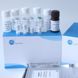 Macrophage m-CSF ELISA Kit Goedgekeurd FDA van de Kolonie Bevorderende Factor