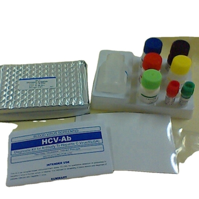 Interleukin 1 Bètauitrusting Menselijke Il1b Elisa Kit Reaserch Use van de elisaopsporing