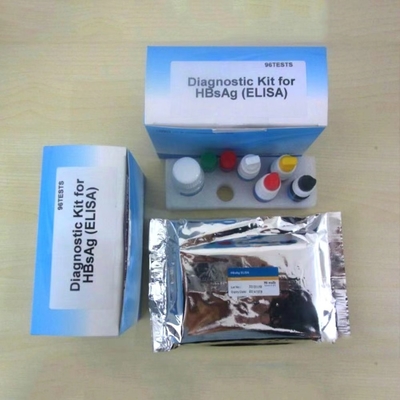 odm Elisa Diagnostic Kit For Hepatitis B het Antigeen van de Virusoppervlakte