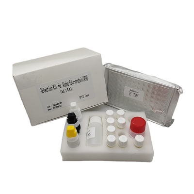Kwantitatieve Alpha Fetoprotein Elisa Detection Kit AFP in Menselijk Serum