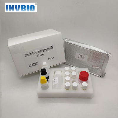 Menselijk Vrij Thyroxine Ft4 Elisa Test Kit Easy To Gebruik