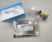 De Kernantigeen Elisa Home Test Kit van het hepatitisb Virus 96 Stukken Hoog rendement